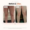 Vaginal Ingrown Hair Serum