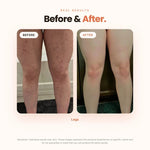 Vaginal Ingrown Hair Serum