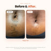 Vaginal Ingrown Hair Serum