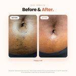 Vaginal Ingrown Hair Serum